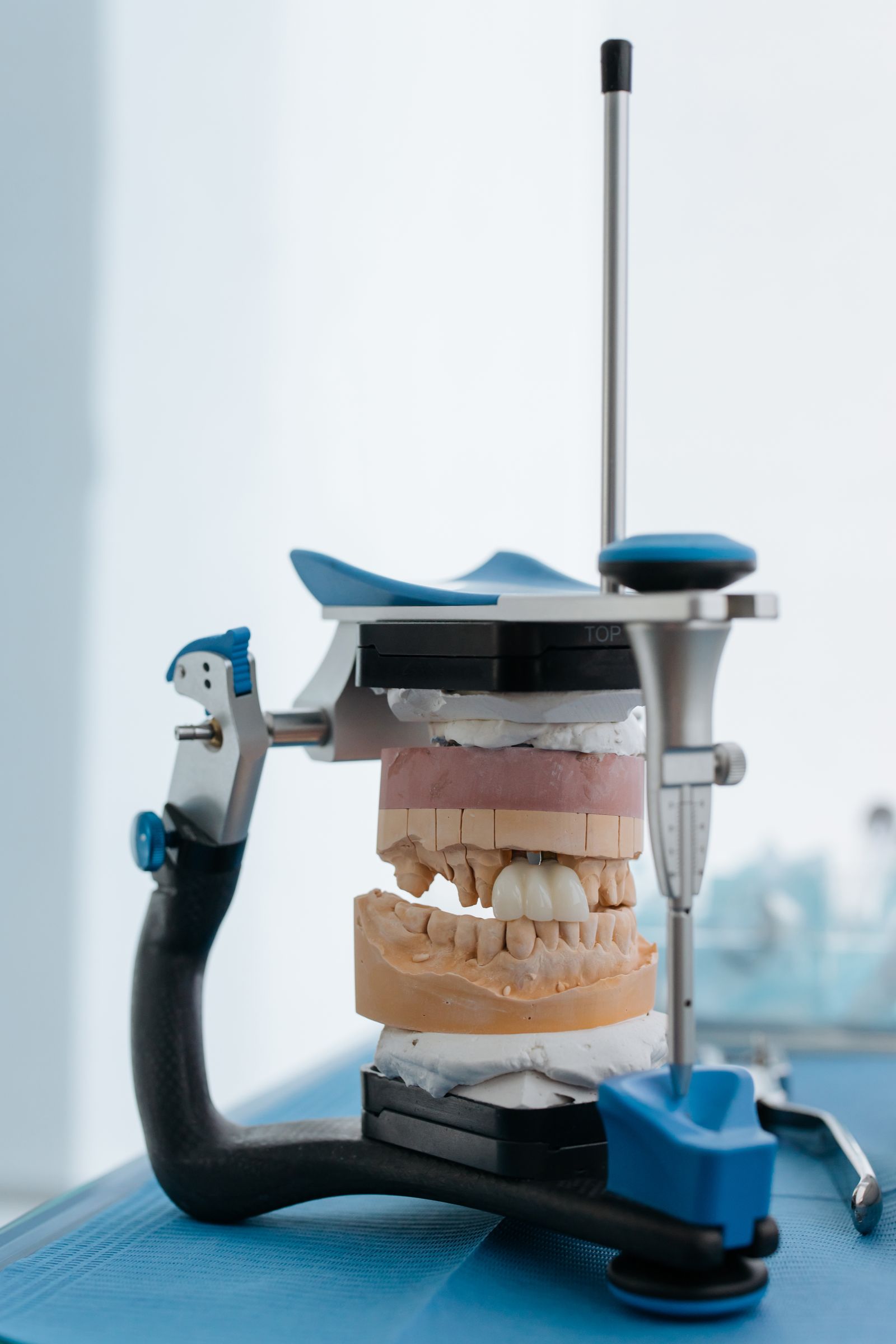 Model čeľuste so zubným implantátom